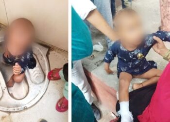 मासूम बच्ची का टॉयलेट में फंसा एक पैर और बाहर निकलने के बाद पैर में लगी पट्टी.